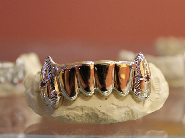 One of the grillz from STL Grillzz