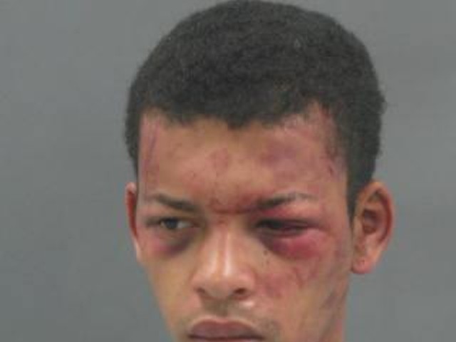 Get Arrested on Charges of Shooting a Cop Eight Times, This is What You're Gonna Look Like