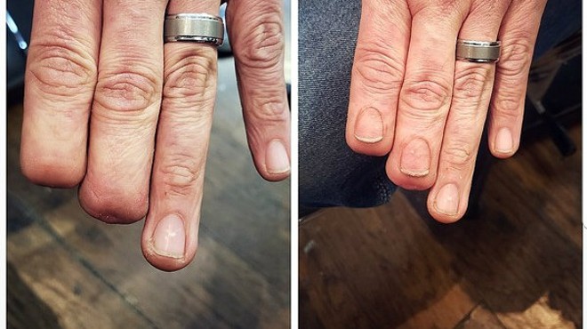 His Hyper-Realistic Fingernail Tattoo Went Viral. Now He Plans to Help More People