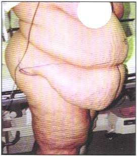 Number 4: This pannus pic came into play in a Reddit discussion thread. Let's just leave it at that. - i.imgur.com