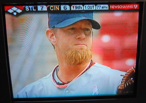 Updated photo: Franklin's beard on May 10, 2009.