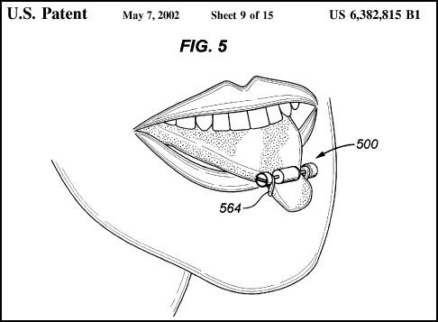 Oral Argument: Ladue-Based Creator of Tongue Vibrators Sues Chinese-Knockoff Vendors