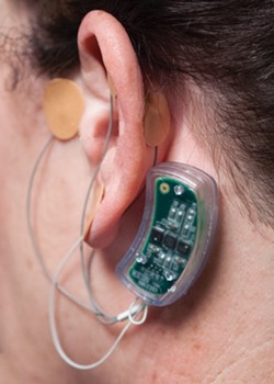 The Bridge is fitted behind a patient's ear, where it remains active for five days. - COURTESY OF INNOVATIVE HEALTH SOLUTIONS