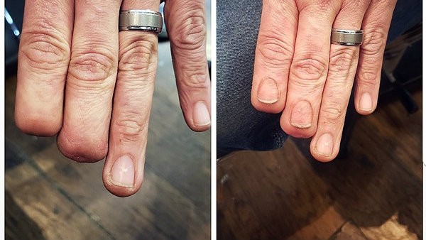 His Hyper-Realistic Fingernail Tattoo Went Viral. Now He Plans to Help More  People | St. Louis Metro News | St. Louis | St. Louis Riverfront Times