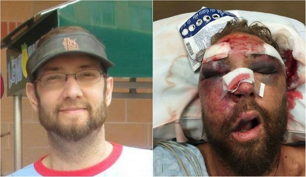 Rob Ludwig was badly beaten after his girlfriend tried to stop harassment of a young neighbor. - COURTESY OF ROB LUDWIG