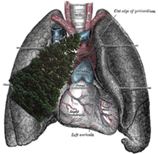 List 90+ Images fir trees can grow in human lungs Updated